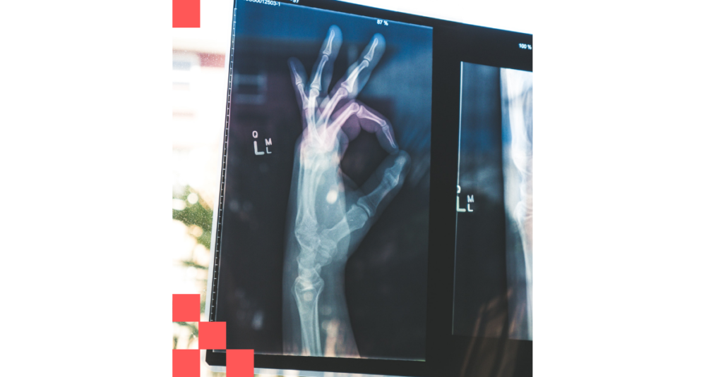 An x-ray scan of a hand showing the OK gesture, meaning that everything will be OK in the healthcare sector with Python-powered diagnostics technology.